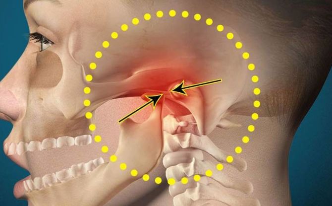 Prečo bolesť čeľuste pri uchu bolí z jednej alebo z dvoch strán, možnosti liečby