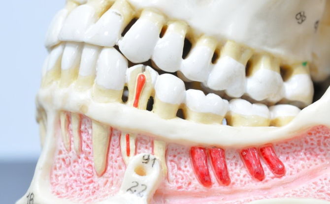 Болести зуба и усне шупљине код људи: узроци, списак имена са фотографијама и описима