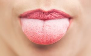 Jerawat merah pada lidah: betapa berbahaya dan bagaimana untuk menyembuhkannya
