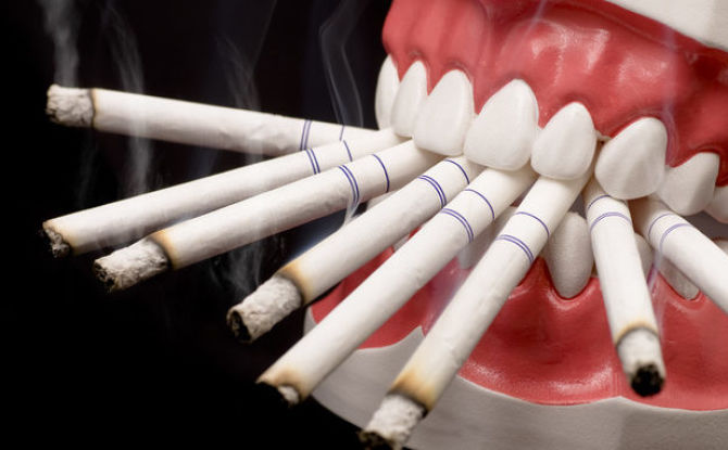 Quelle quantité ne peut pas être fumée après une extraction dentaire et pourquoi