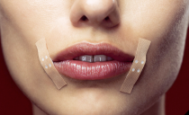 Risse in den Lippenwinkeln: Ursachen, Medikamente und Volksheilmittel