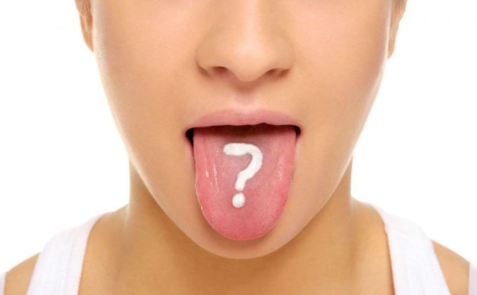 Candidoza în limbaj: simptome, tratament, prevenție