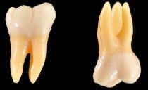 ما تسمى الأسنان الضرس والضواحك ، والسمات التشريحية