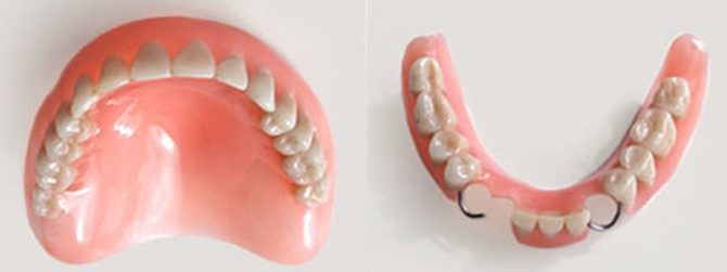 Răng giả acrylic