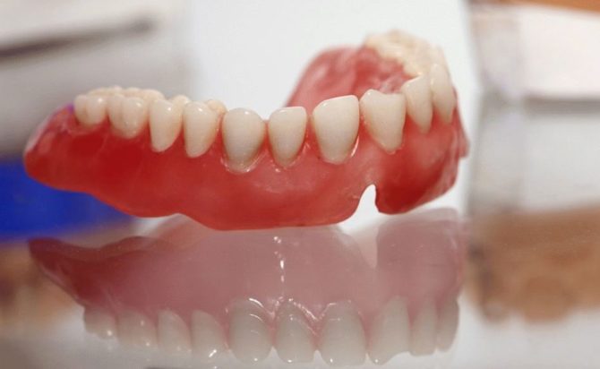 Hàm răng giả acrylic