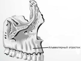 Alveolar ridge
