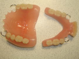 Partial removable plate prosthesis