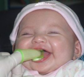 Limpeza da língua de um bebê de sapinhos com solução de refrigerante