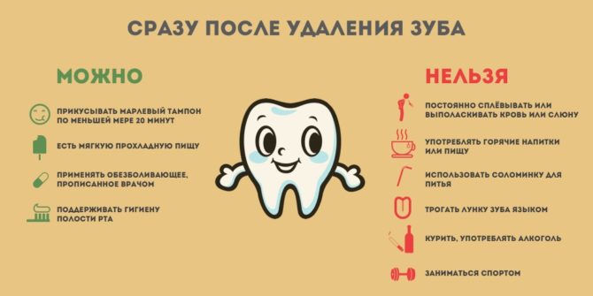 Những gì có thể và không thể được thực hiện sau khi nhổ răng