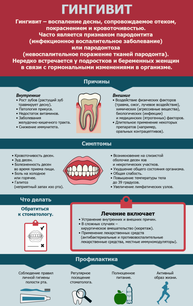 Zánět dásní - infografika