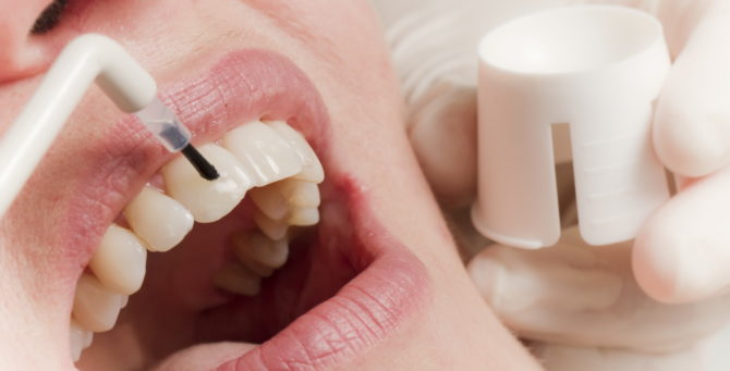 Tiefe Fluoridierung der Zähne