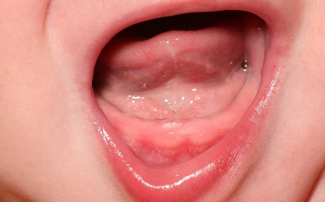 Hvordan ser tannkjøttet ut når du tenner den første tannen