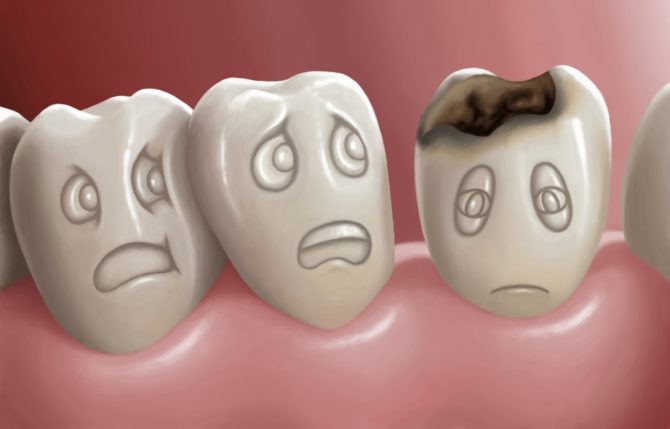 Tandförfall