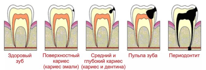 Classification of dental diseases