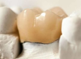 Corona dentale