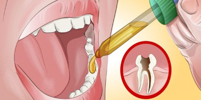 Tooth treatment at home