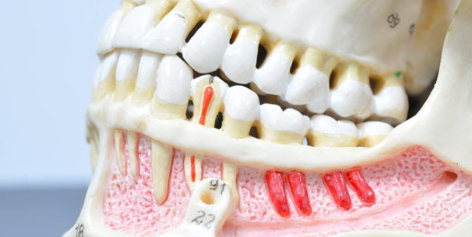 Layout of sick and healthy teeth
