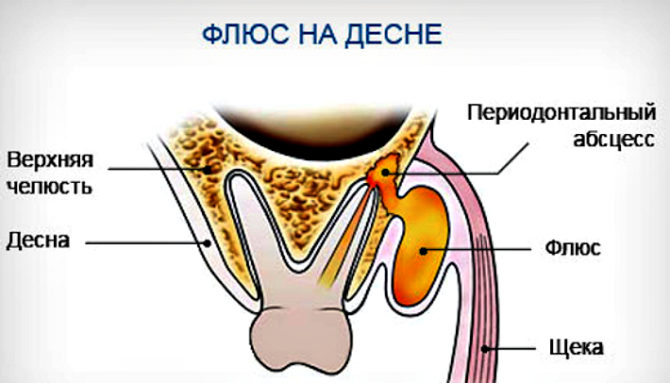 Mecanismul de formare a fluxului de gingie