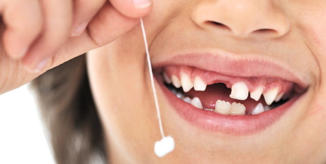 Răng sữa được thay thế bằng răng hàm