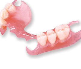 Nylon partial denture