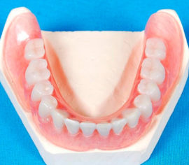 Prótesis de nylon de mandíbula inferior