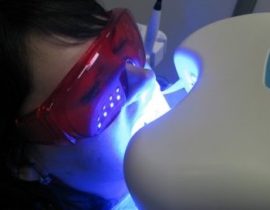 Tratamiento de rayos UV