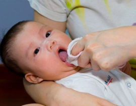 Tratamiento de la cavidad oral de un bebé con un antiséptico.