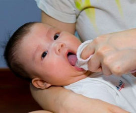 Behandlung der Mundschleimhaut bei Säuglingen