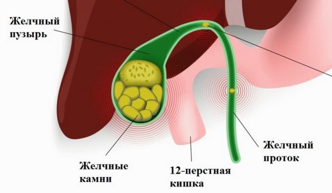 Az epevezeték patológiája