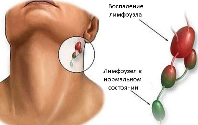 Submandibular lymfeknute i normal og betent tilstand