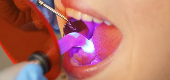 Drying light fillings with an ultraviolet lamp