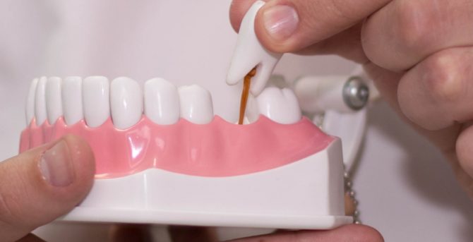 Zubní protetika