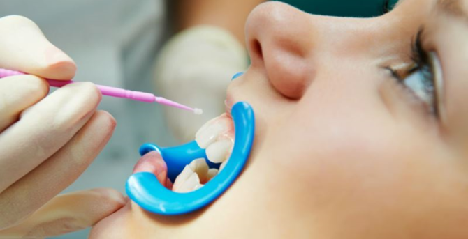 Proces postriebrenia zubov