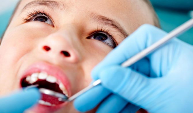 Pulpitída mliečnych zubov u detí