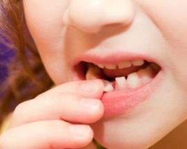 Smanjivanje dječjeg zuba