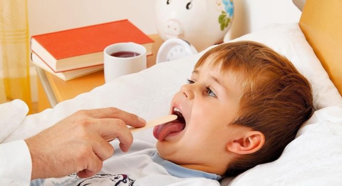 طفل مع التهاب الفم
