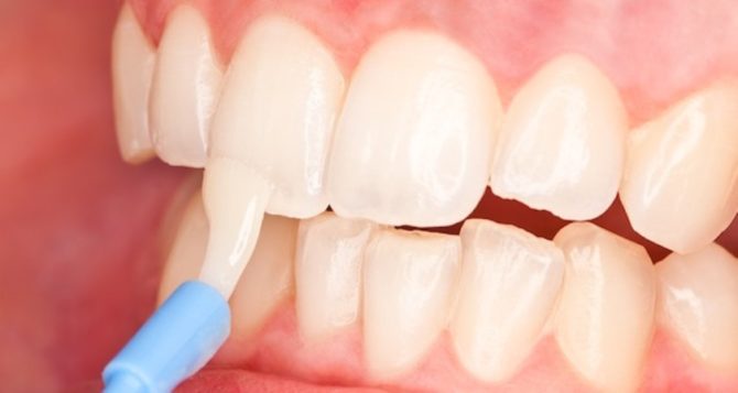 Remineralizácia zubnej skloviny