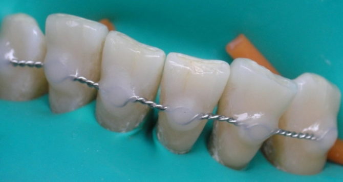 Zupčasti zubi