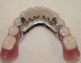 Dantų sąsagos protezas