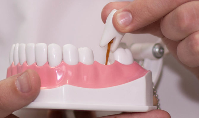 طبيب عظام الأسنان يضع أطقم الأسنان