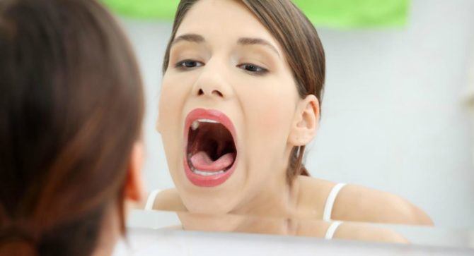 Una donna ha ulcere sulle tonsille
