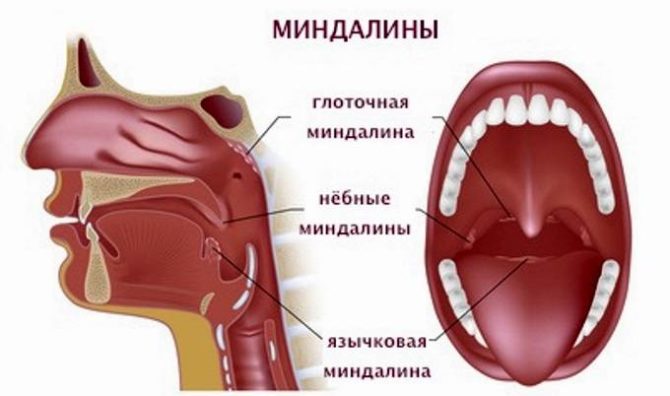 Tipos y ubicación de las amígdalas.