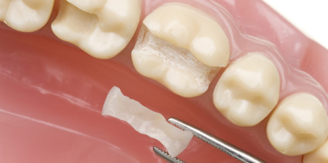 Tooth restoration tab
