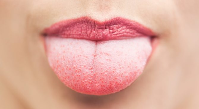 Tongue with red pimples
