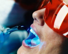 čistenie zubov laserom