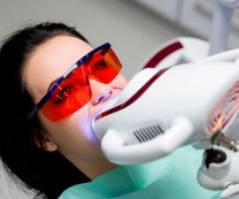 Clareamento dos dentes a laser
