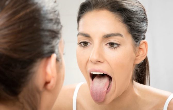 Moteris turi liežuvio glositą