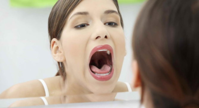 Woman has mouth sores